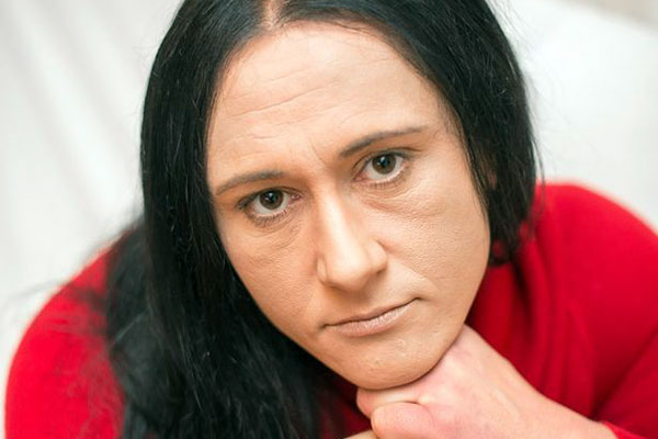 Из-за редкого заболевания британская «спящая красавица» бодрствует лишь 3 часа в сутки